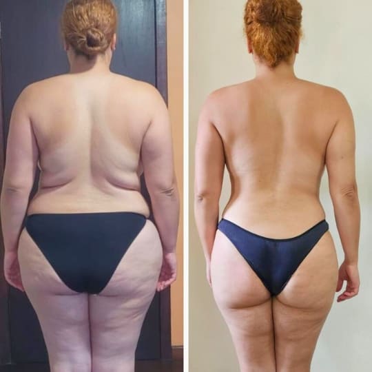 antes e depois1