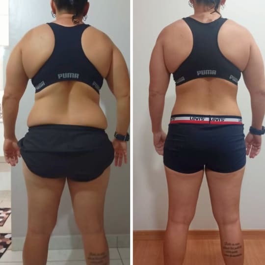 antes e depois3